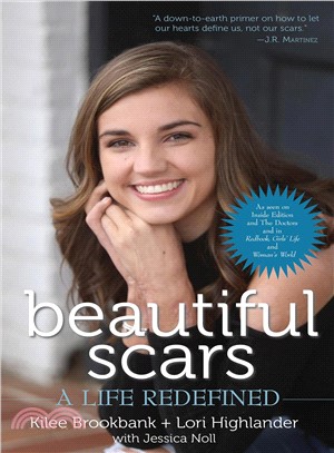 Beautiful Scars ─ A Life Redefined