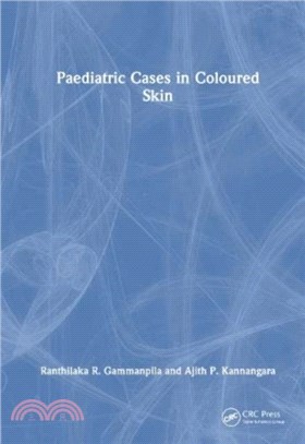 Paediatric Cases in Coloured Skin