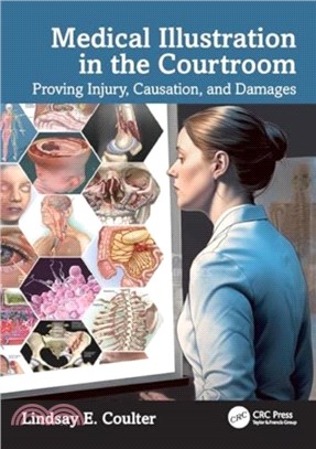 Medical Illustration in the Courtroom：Proving Injury, Causation, and Damages