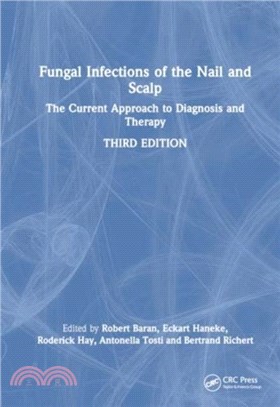 Fungal Infections of the Nail and Scalp：The Current Approach to Diagnosis and Therapy