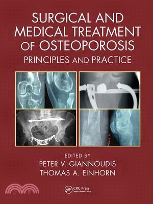 Surgical and Medical Treatment of Osteoporosis: Principles and Practice