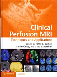 Clinical Perfusion MRI ─ Techniques and Applications