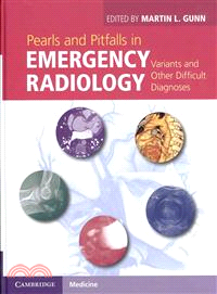 Pearls and Pitfalls in Emergency Radiology ─ Variants and Other Difficult Diagnoses