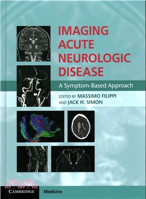 Imaging Acute Neurologic Disease ― A Symptom-based Approach