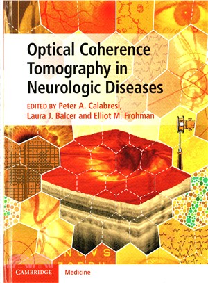 Optical Coherence Tomography in Neurologic Diseases