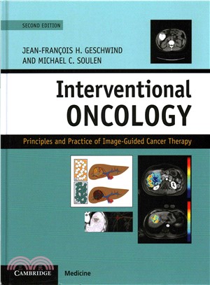 Interventional Oncology ― Principles and Practice of Image-guided Cancer Therapy