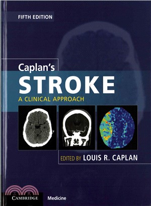 Caplan's Stroke ― A Clinical Approach