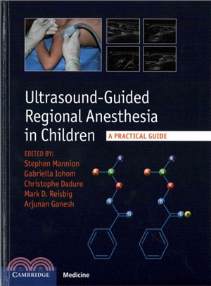 Ultrasound-guided Regional Anesthesia in Children ― A Practical Guide