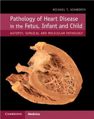 Pathology of Heart Disease in the Fetus, Infant and Child ― Autopsy, Surgical and Molecular Pathology