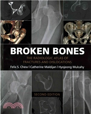 Broken Bones ― The Radiologic Atlas of Fractures and Dislocations