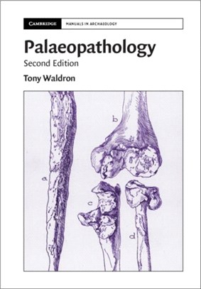 Palaeopathology