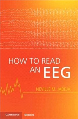 How to Read an Eeg