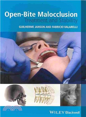 Open-Bite Malocclusion: Treatment And Stability