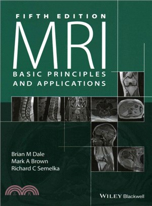 MRI basic principles and app...