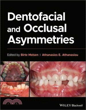 Dentofacial and Occlusal Asymmetries