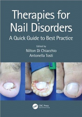 Therapies for Nail Disorders：A Quick Guide to Best Practice