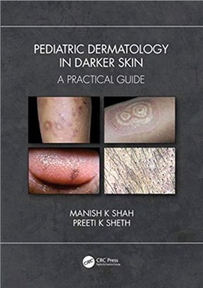 Pediatric Dermatology in Darker Skin：A Practical Guide