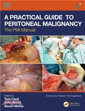 A Practical Guide to Peritoneal Malignancy：The PMI Manual