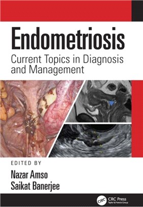 Endometriosis：Current Topics in Diagnosis and Management