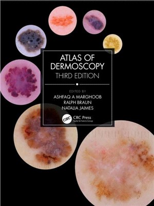 Atlas of Dermoscopy：Third Edition