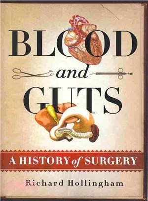 Blood and Guts ─ A History of Surgery
