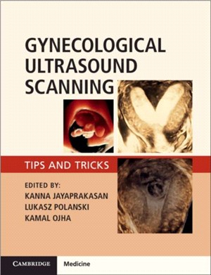 Gynaecological Ultrasound Scanning ― Tips and Tricks