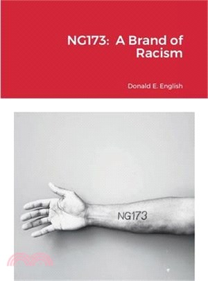 Ng173: A Brand of Racism