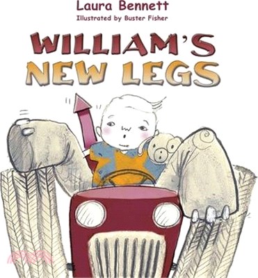 William's New Legs