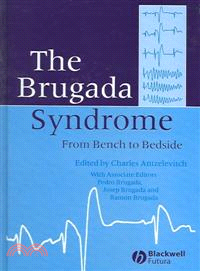 The Brugada Syndrome - From Bench To Bedside