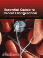 Essential Guide to Blood Coagulation