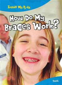 How Do Braces Work?: Teeth