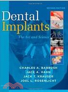 Dental Implants: The Art and Science