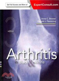 Arthritis in black and white