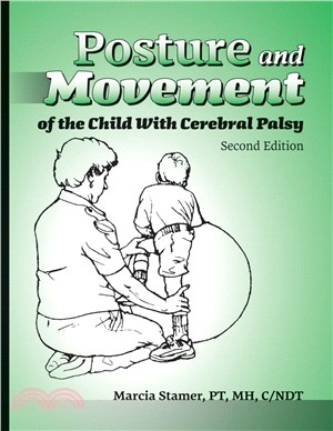 Posture and Movement of the Child With Cerebral Palsy