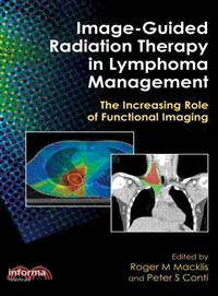 Image-Guided Radiation Therapy in Lymphoma Management: The Increasing Role of Functional Imaging