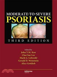 Moderate-to-Severe Psoriasis