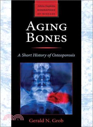 Aging Bones ─ A Short History of Osteoporosis