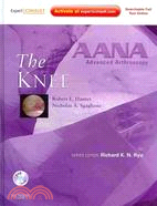 The Knee: Expert Consult