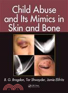 Child Abuse and Its Mimics in Skin and Bone