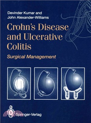 Crohn's Disease and Ulcerative Colitis ― Surgical Management