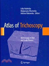 Atlas of Trichoscopy—Dermoscopy in Hair and Scalp Disease