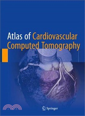 Atlas of Cardiovascular Computed Tomography + Ereference