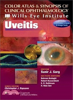 Uveitis ─ Color Atlas and Synopsis of Clinical Ophthalmology