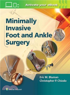 Minimally invasive foot and ...