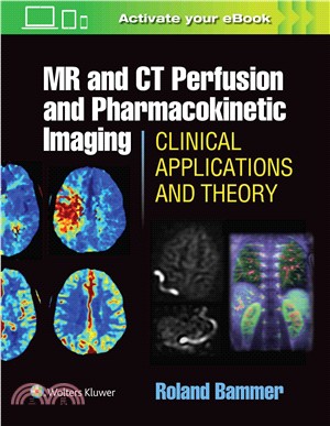 Mr and Ct Perfusion and Pharmacokinetic Imaging ─ Clinical Applications and Theoretical Principles