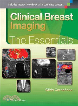 Clinical Breast Imaging ─ The Essentials