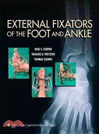 External Fixators of the Foot and Ankle