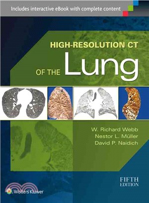 High-Resolution CT of the Lung