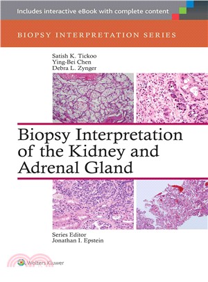 Biopsy interpretation of the...