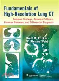 Fundamentals of High-Resolution Lung CT ─ Common Findings, Common Patterns, Common Diseases, and Differential Diagnosis